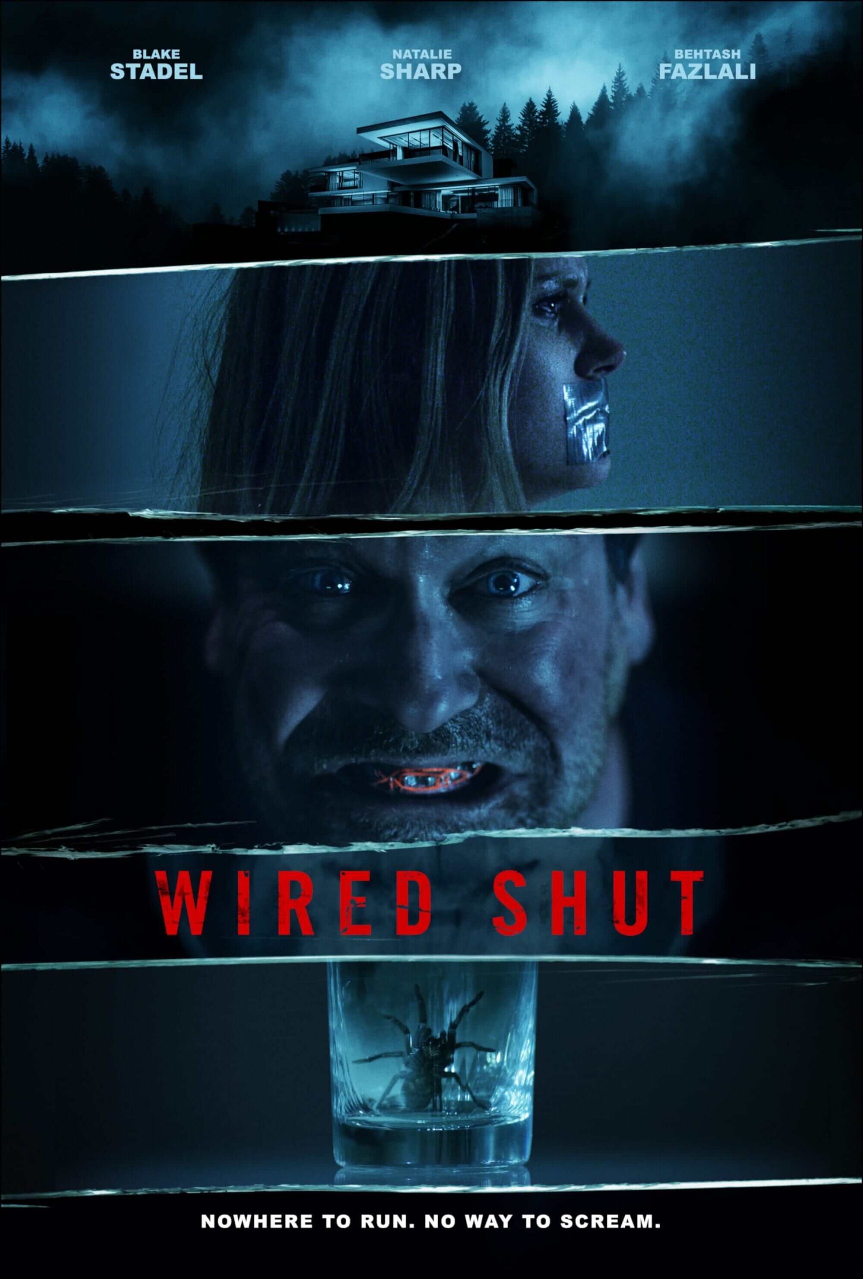 قفل آرواره (Wired Shut)